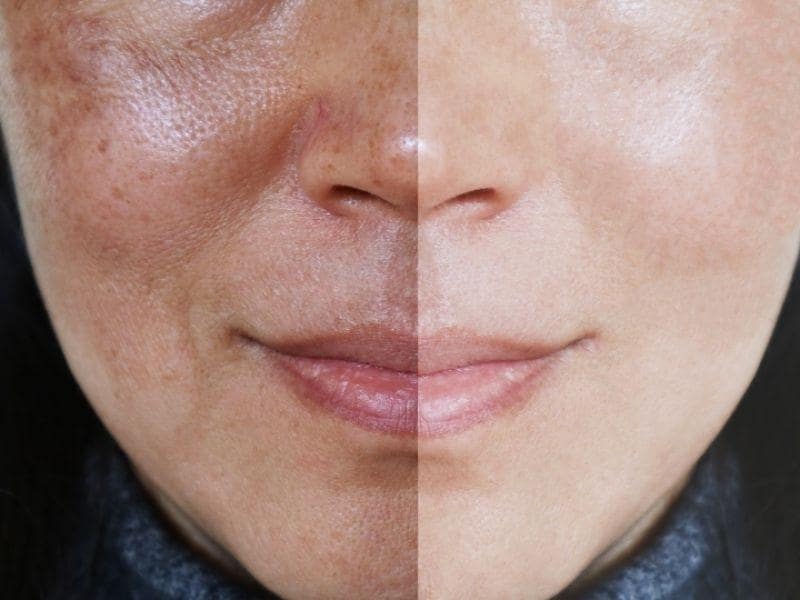 Kit Cata Oferta 12 harpagofito-voltrem-opt