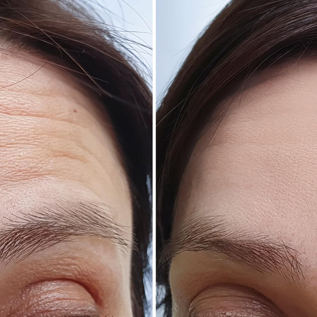 37-min dolor-lumbar-2021