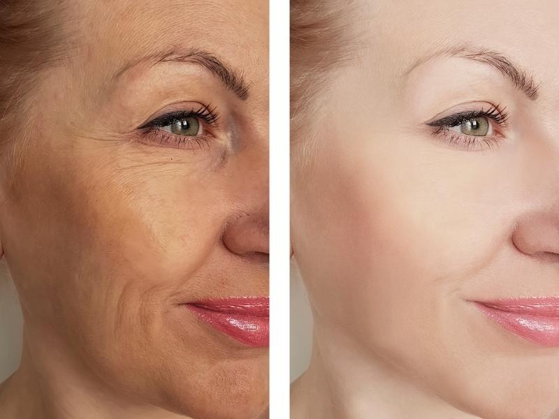 Kit Cata Oferta 11 9 min 3